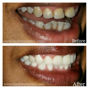 Img SmileMakeover 1